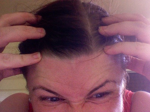 Side Effects of Tea Tree Oil