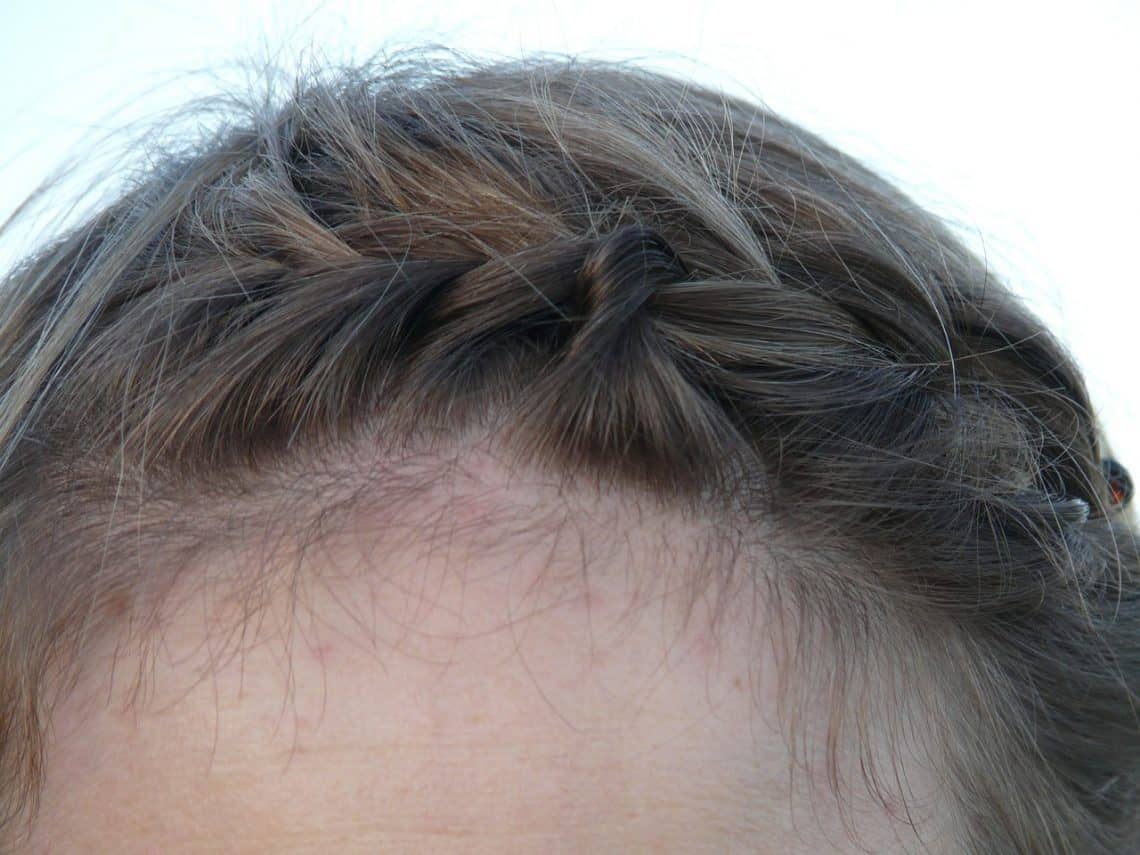 Anti-Dandruff Shampoo
