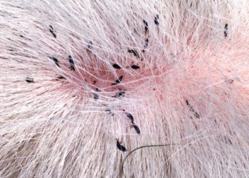 tea tree oil for scalp