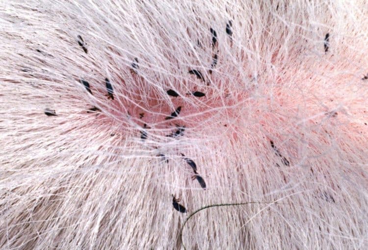 tea tree oil for scalp